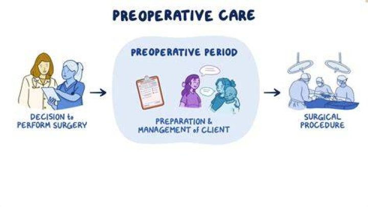 The Ultimate Guide For Pre-Surgery Conversations